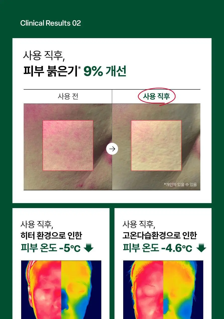 [NEW/미니어처증정] 닥터지 레드 블레미쉬 10-시카 캡슐 수딩 토너 300ml 기획 (+100ml) 상세페이지 22